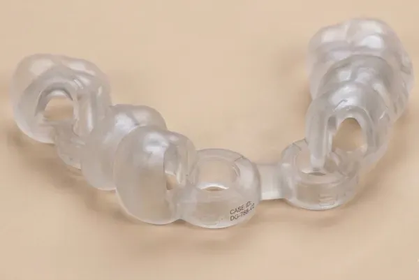 骨の内部を通る神経や血管を避けて計画通りの位置に安全に埋入するために作製されたオーダーメイドのサージカルガイド
