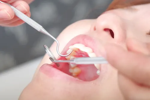患者様の不安や痛みに寄り添い丁寧に行う歯科医師の診療・治療風景