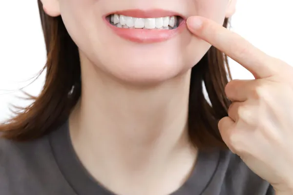 歯を削ることなく専用のホワイトニング薬剤を用いて自然で清潔感のある白い歯へとトーンアップした笑顔